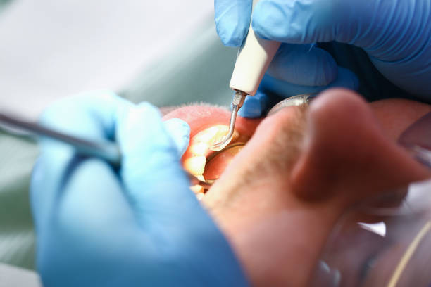 Best Dentist for Tooth Abscess  in Powhatan Point, OH