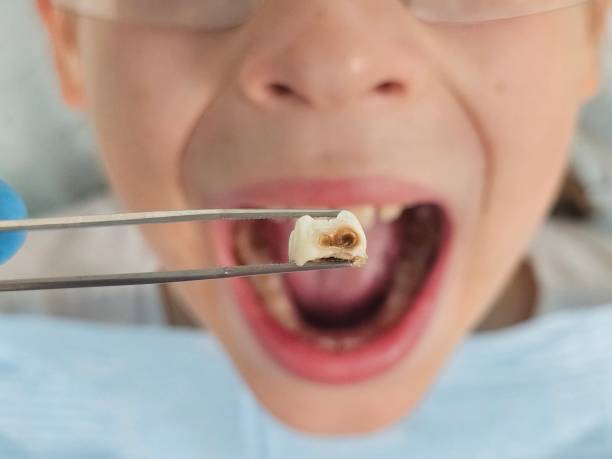 Best Emergency Dental Filling Replacement  in Powhatan Point, OH